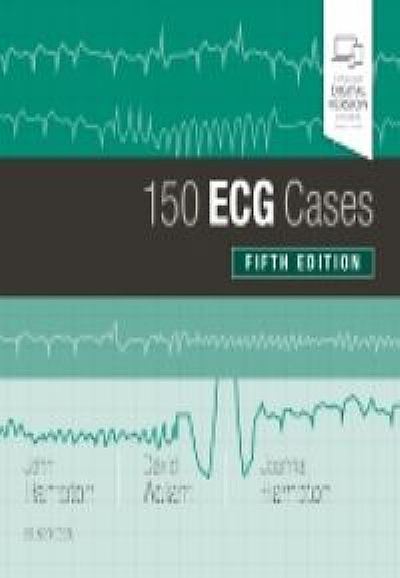 150 ECG Cases, 5th Edition Authors : John R. Hampton & David Adlam ...